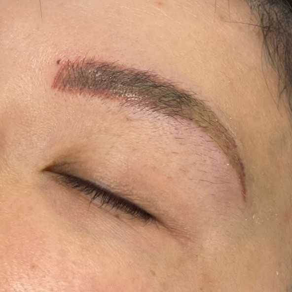 Eyebrow Tattoo Removal | Sydney Lash & Brow in Bondi Junction